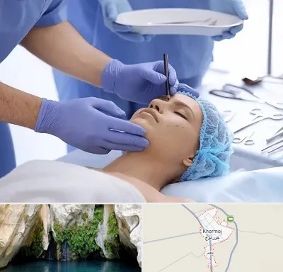 عمل بینی طبیعی در خورموج