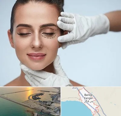 عمل پف چشم در بندر کنگان