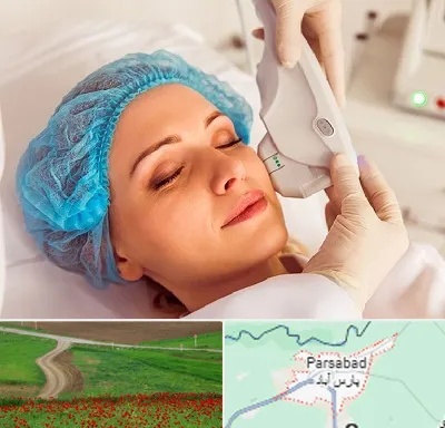 اکسنت در پارس آباد
