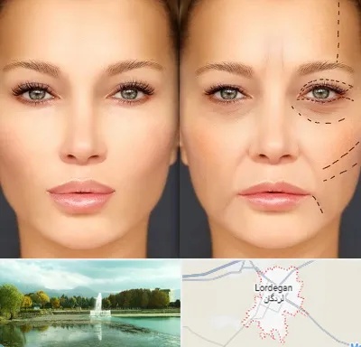 متخصص زیبایی چشم در لردگان