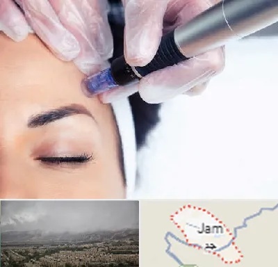 کلینیک مزوتراپی صورت در جم