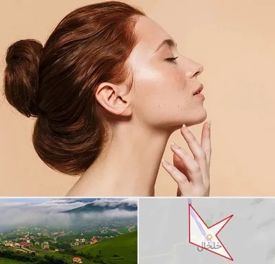 جراحی غبغب در خلخال