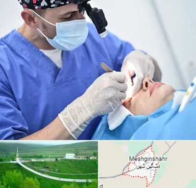 جراح سرطان چشم در مشگین شهر
