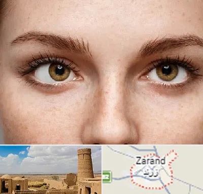 متخصص انحراف چشم در زرند