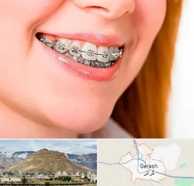 ارتودنسی ارزان در گراش