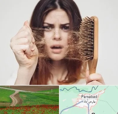 دکتر ریزش مو در پارس آباد