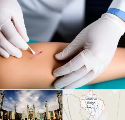 متخصص زخم عفونی در آران و بیدگل