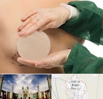 جراحی پروتز سینه در آران و بیدگل