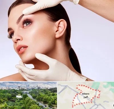 دکتر رفع غبغب در البرز