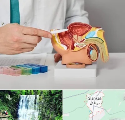 دکتر اورولوژی در سیاهکل