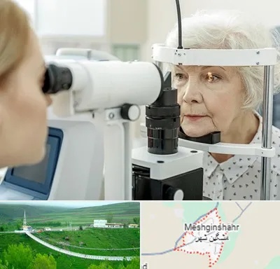 چشم پزشک خانم در مشگین شهر