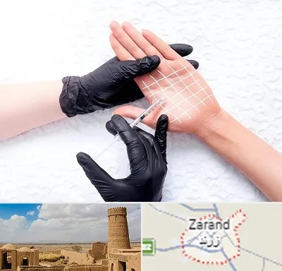 تزریق بوتاکس کف دست در زرند