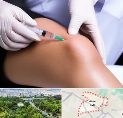 پلاسما درمانی PRP در البرز