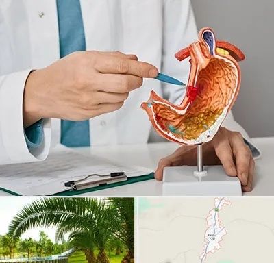 دکتر سرطان معده در کهنوج