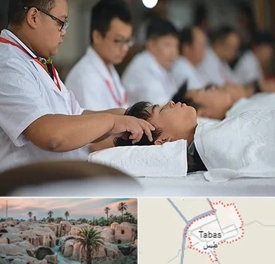 طب چینی در طبس