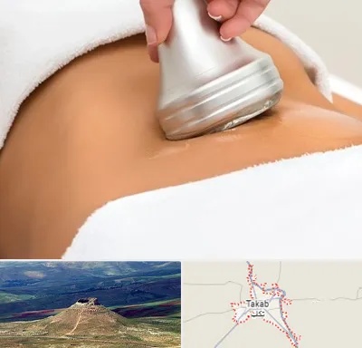 دستگاه لاغری در تکاب
