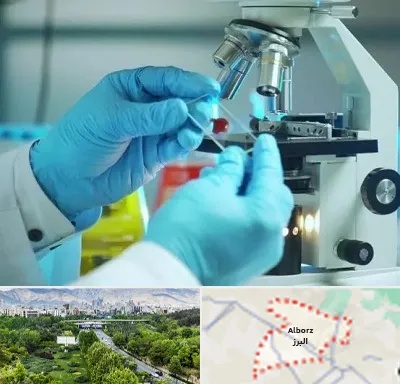 آزمایشگاه با جواب فوری در البرز