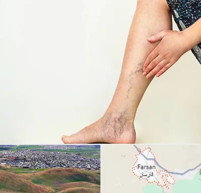 دکتر واریس در فارسان
