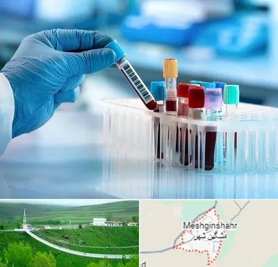آزمایشگاه خون قبل از ازدواج در مشگین شهر