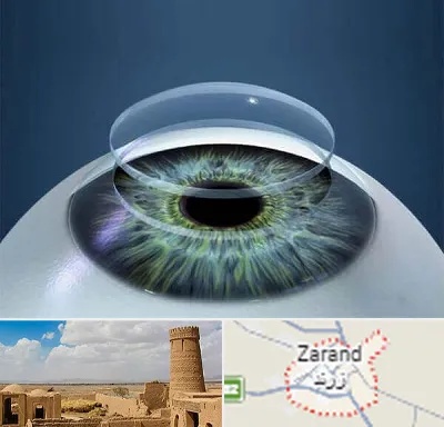 پیوند قرنیه در زرند