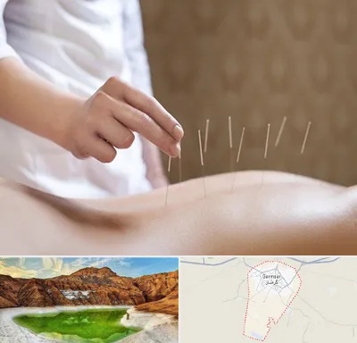 درای نیدلینگ در گرمسار