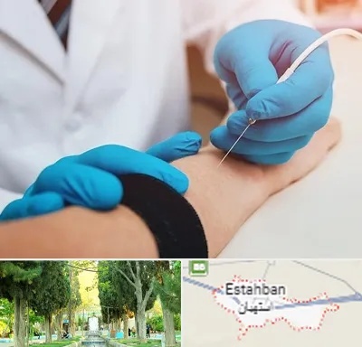 مرکز نوار عصب و عضله در استهبان