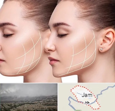 جراحی بوکال فت در جم
