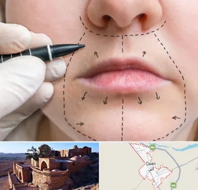 عمل سانترال لب در قائن