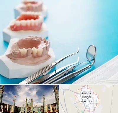 متخصص روکش دندان در آران و بیدگل