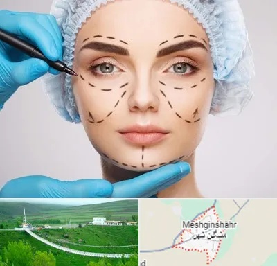 جراح پلاستیک در مشگین شهر