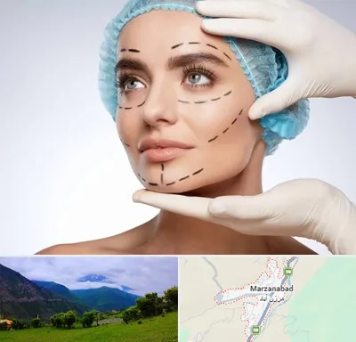 جراحی زیبایی در مرزن آباد