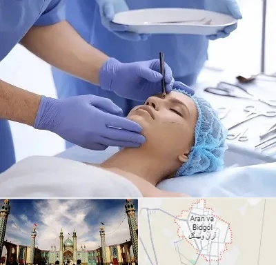 عمل بینی طبیعی در آران و بیدگل
