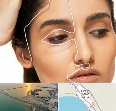 عمل بینی اقساطی در بندر کنگان