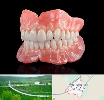 ساخت دندان مصنوعی در مشگین شهر