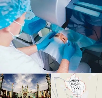 دکتر عمل لازک چشم در آران و بیدگل