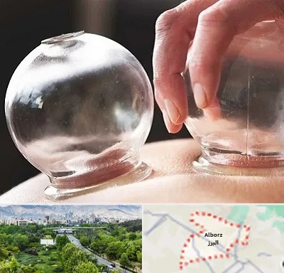مرکز حجامت در البرز