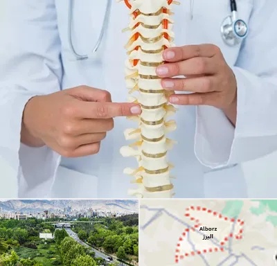 جراح ستون فقرات در البرز