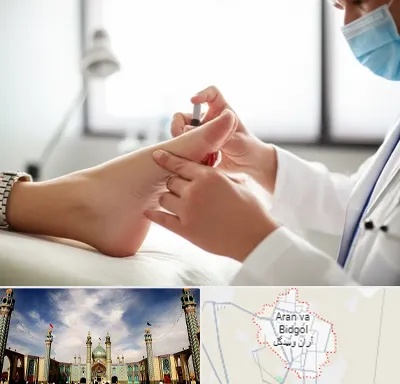 متخصص زخم دیابت در آران و بیدگل