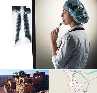 دکتر سرطان ریه در قائن