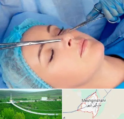 عمل بینی نیمه فانتزی در مشگین شهر