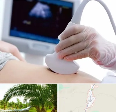 سونوگرافی در کهنوج