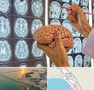 دکتر فوق تخصص جراح مغز و اعصاب در بندر کنگان