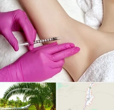 تزریق بوتاکس زیر بغل در کهنوج