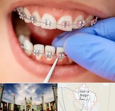 مرکز ارتودنسی دندان در آران و بیدگل