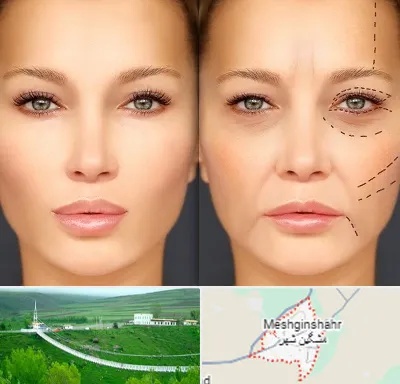 متخصص زیبایی چشم در مشگین شهر