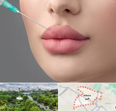 کلینیک ژل لب روسی در البرز