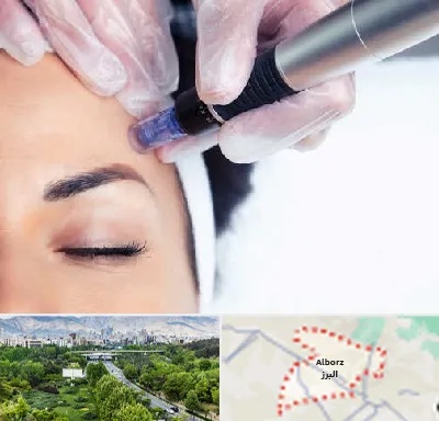 کلینیک مزوتراپی صورت در البرز