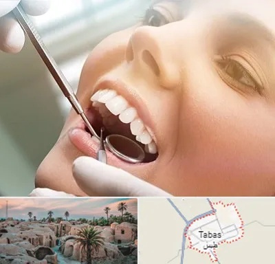 دندانپزشکی زیبایی در طبس