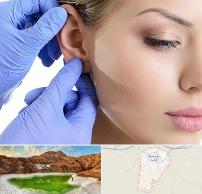 اتوپلاستی در گرمسار
