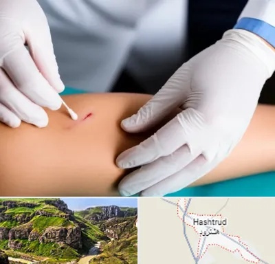 متخصص زخم عفونی در هشترود